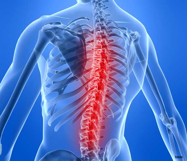 Back Pain Solutions