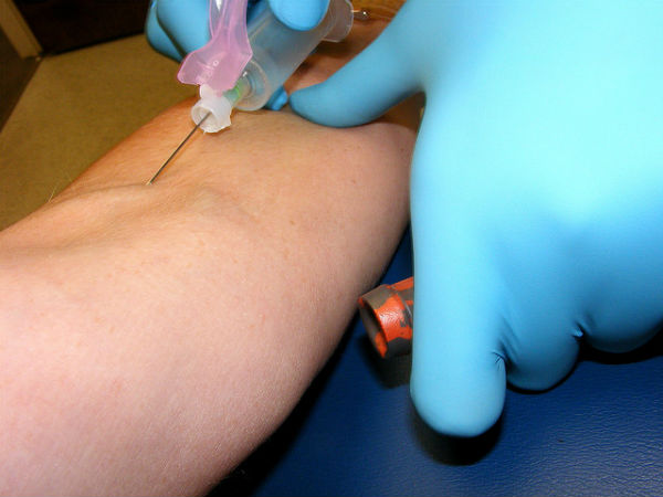 Should You Take Your Health Into Your Hands?