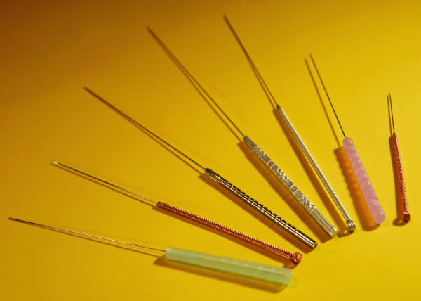 Acupuncture used for allergies may have additional benefits over medication.