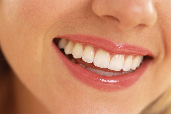 Teeth Implant costs
