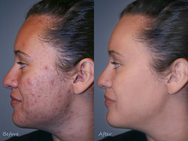 Skin Care