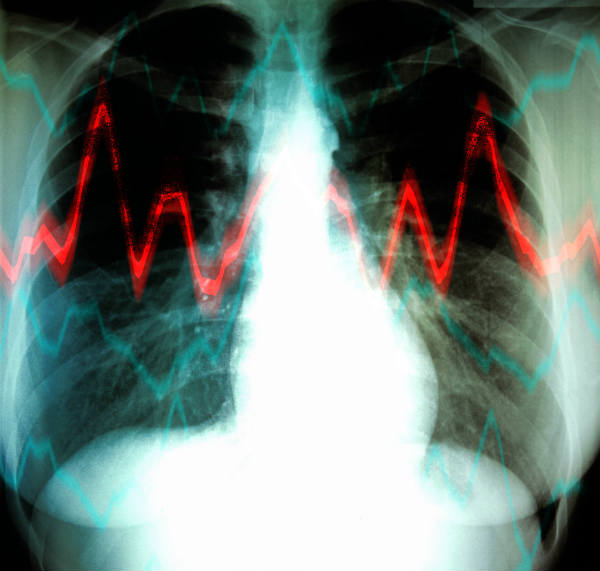 How to Have Healthy Lungs