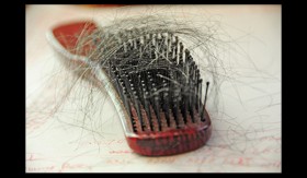 Truth Behind Hair Loss – Some Common Myths Debunked!