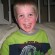 3 Main Types of Allergies in Children