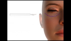 Latest and Strangest Trends in Plastic Surgery