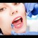 Defeating Dental Phobia With Sedation Dentistry
